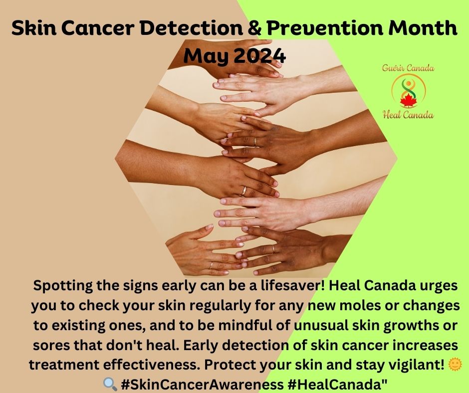 Skin Cancer, know the signs and symptoms! Enjoy the sun responsibly!!! #healcanada #patientadvocacy #saveyourskin