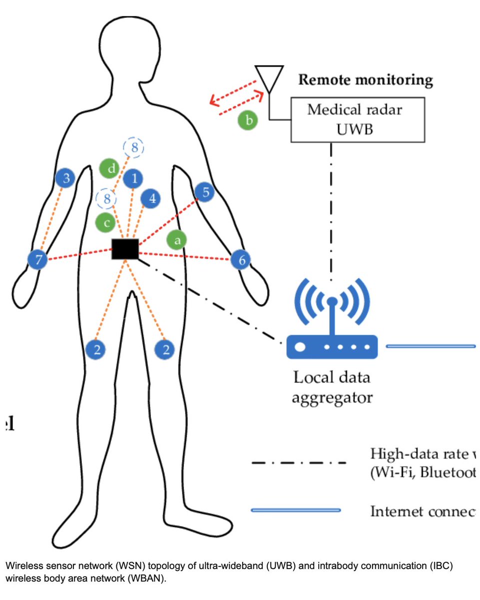 WiFi.

I didn't sign up for it.

#NurembergCode

IEEE 802.15.6

IEEE 802.15.4

#RemoteHELLthcare

#MedicalBodyAreaNetwork 

Computer Networking through the Human Body without informed consent

researchgate.net/figure/Wireles…