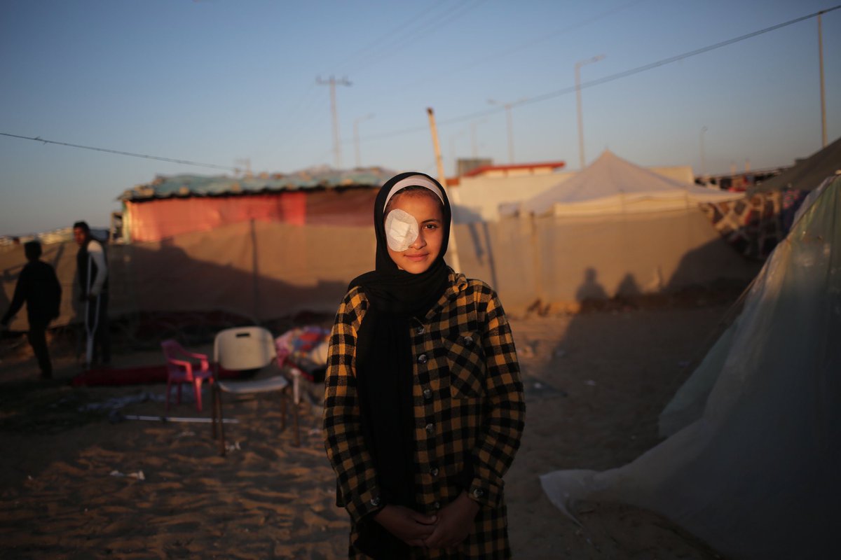 Abrar, 15-year-old, who was hit by shrapnel. “When my house was bombed and destroyed, two of my brothers were killed, and a third one was injured. Some shrapnel hit my right eye, causing weak eyesight and constant tears.” Photo by UNICEF.