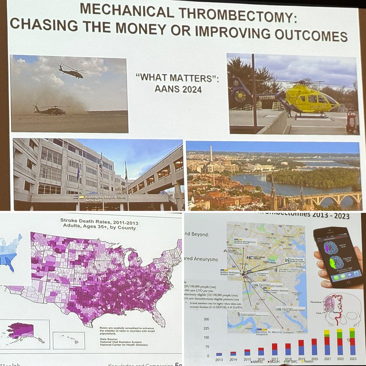 Dr. Rocco Armonda on weighing costs with clinical outcome for thrombectomy @MedStarHealth #AANS2024 #whatmatters2me @AANSNeuro @IsaacYangMD @UCLAHealth @UCLANsgy @HarborUCLA @HarborUCLASurg #skullbase