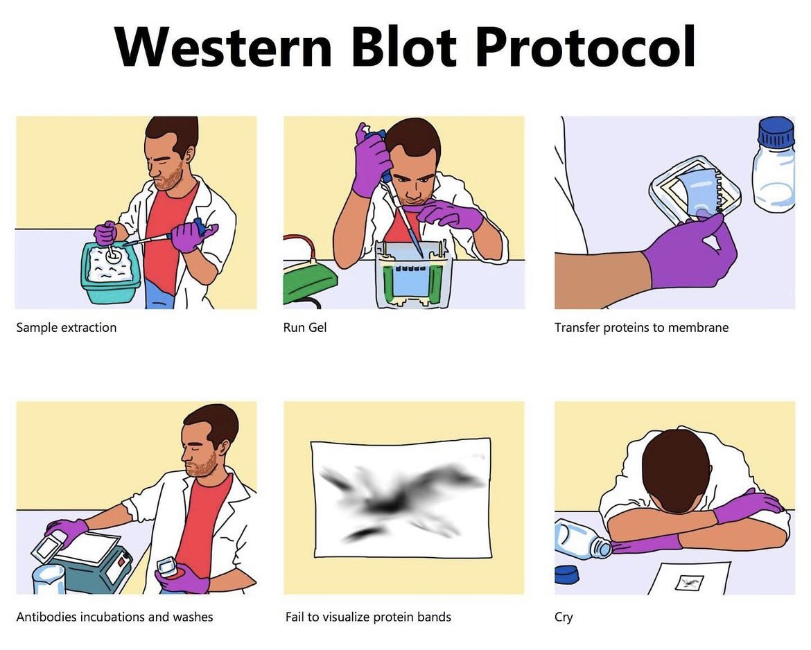 #WesternBlot pişmanlıktır 😂😂 #Wetlab #Science Hele ki bunu loop’a aldığınızı düşünün..