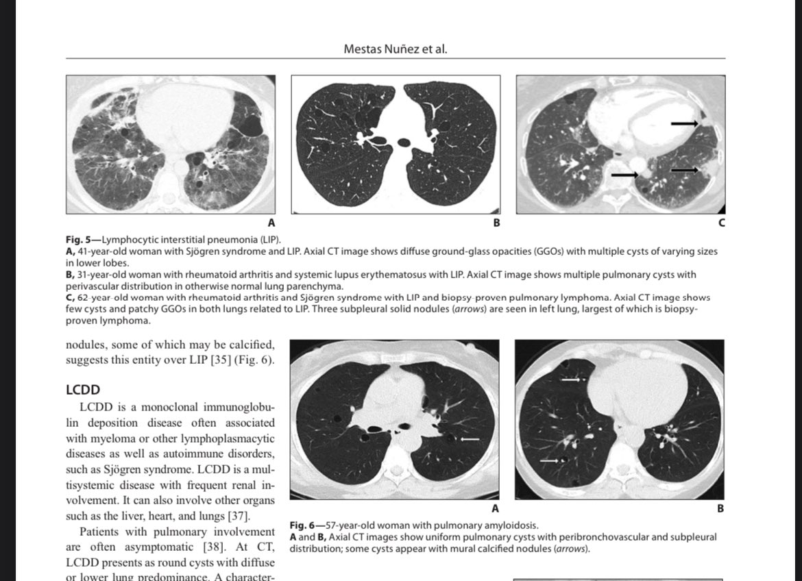 So nice to see the syllabus for the @ARRS_Radiology #ARRS24 meeting categorical course on HRCT 🫁published! 👏👏 @marcosmestas and @DulcichGonzalo for the great work on our chapter on Diffuse Cystic Lung Diseases! Looking forward to Boston this week! #chestrads #Radiology