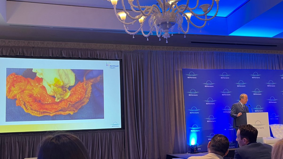 #IBDHorizons24 @FezaRemziMD #IBD surgery is a lifelong relationship between the CRS & patient‼️ Some pts would rather have ileo than #jpouch 👂Listen to the pt in front of you, don't instill bias 🖐️Digital exam very important part of surgical procedure