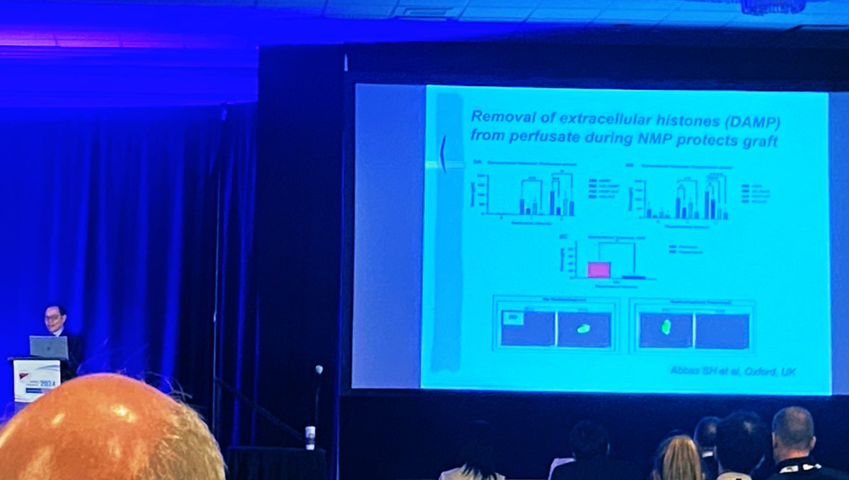 Lovely to see our work highlighted in the “best of basic science” session, wrapping up a fantastic #ILTS congress - congratulations @HussainAbbas_HK and the rest of the @OxTxResearch group👏🏾@ILTS_BTSRC @_ILTS_ @NDSurgicalSci @MethodistHosp