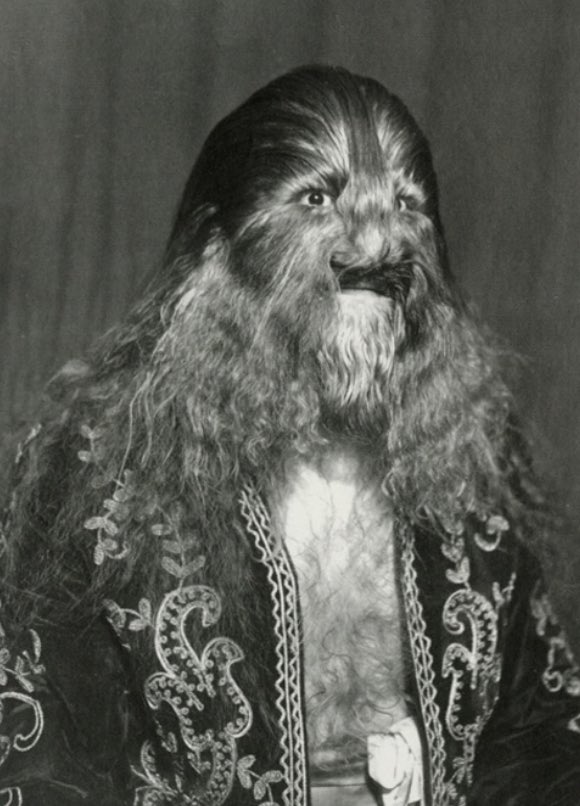 Photograph of Stephan Bibrowski, better known as Lionel the Lion-faced Man. 

Stephan gained fame as a sideshow performer due to his unique appearance—his entire body was covered in long hair, resembling that of a lion. 

This characteristic was likely attributed to a rare…