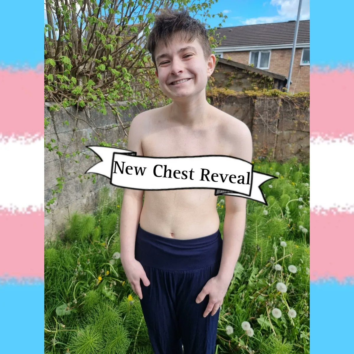 New Chest Just Dropped 🥳🎊
I can't put into words the joy and relief these past 10 days have brought let alone what I feel now I can look at it any time I want to 🥹
#TopSurgery #TopSurgeryRecovery #Trans #TransJoy #TransHealthcare #GenderAffirmingCare #GenderAffirmingHealthcare