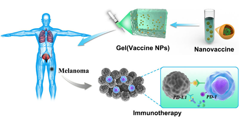 Scientists at @UMassChan @UMassChan_BMB have developed a BCNA-based #nanovaccine with enhanced neoantigen immunogenicity and minimized acute systemic toxicity, which has potential for #personalizedimmunotherapy. @GangHan_UMMS

Read more: go.acs.org/9dh