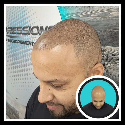 Revitalize your look for the summer with scalp micropigmentation 🔥
#scalpmicropigmentation #bald #thinninghair #menshair #hairtattoo #tattoo #mensgrooming #buzz #smp #buffalo #buffalony