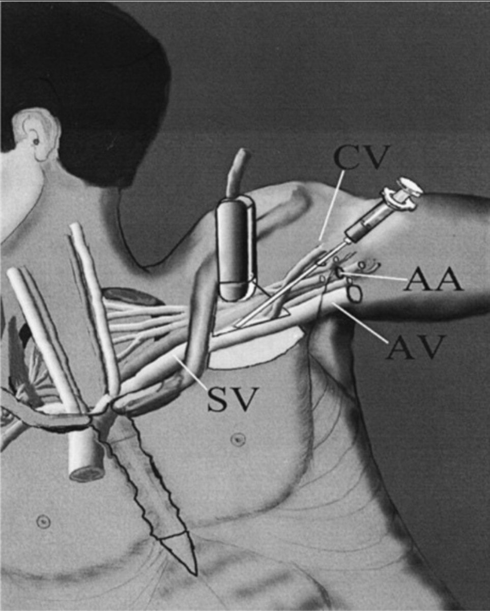 Ed Mariano, MD, MAS, FASA, FASRA tweet media