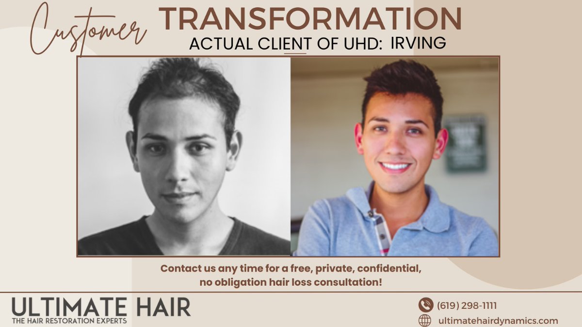 𝐘𝐨𝐮𝐫 𝐡𝐚𝐢𝐫 𝐫𝐞𝐬𝐭𝐨𝐫𝐚𝐭𝐢𝐨𝐧 𝐣𝐨𝐮𝐫𝐧𝐞𝐲 𝐬𝐭𝐚𝐫𝐭𝐬 𝐡𝐞𝐫𝐞!

#HairRestoration #BeforeAndAfter #TransformationTuesday #UltimateHairDynamics #HairLossSolution #SanDiegoHair #HairTransformation  #HairGoals
#HairRestorationJourney #UltimateConfidence'