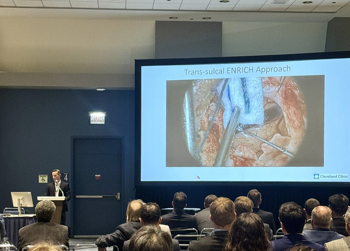 Dr. Mark Bain @bainmd presents technical surgical aspects of the #ENRICH trial and outcome data following #MIS #ICH evacuation. #AANS2024 @AANSNeuro @cvsection @CleClinicMD