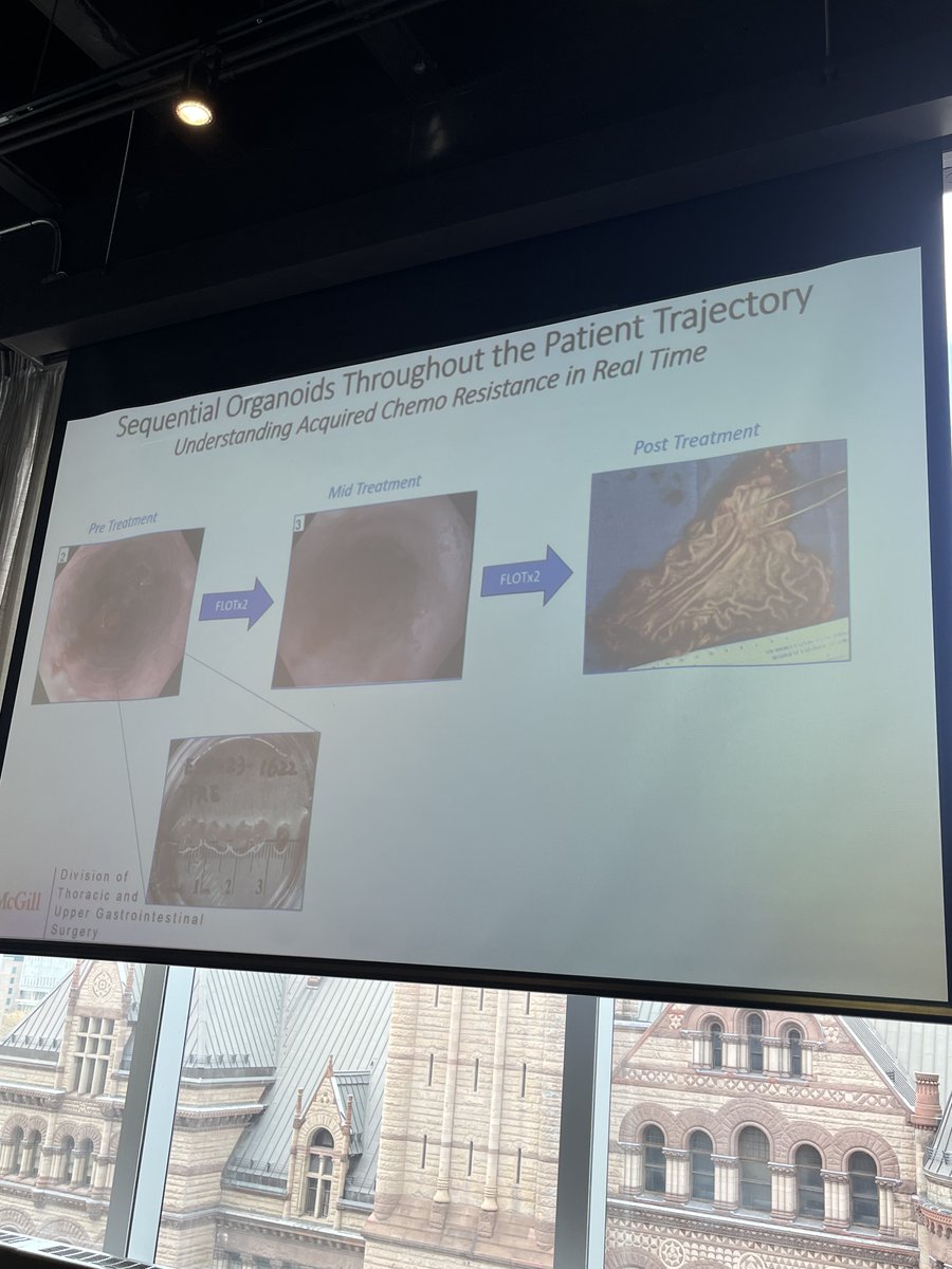 Dr. Lorenzo Ferri discusses his research of tailoring treatments to patients using patient-derived organoids 

the future of #precisiononcology