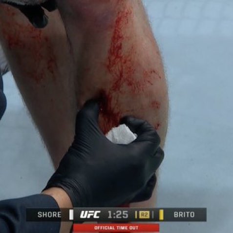 Joanderson Brito’s leg kicks literally put a hole in Jack Shore’s leg. INSANE. 😳 #UFC301