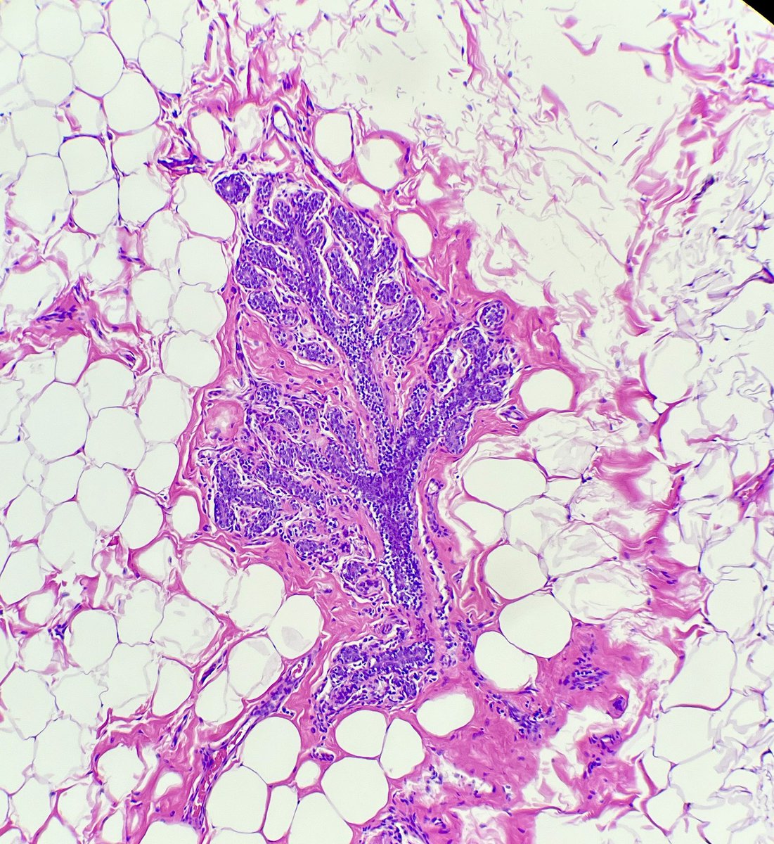 A perfect microscopic tree 😍 #breastpath #pathx #PathTwitter