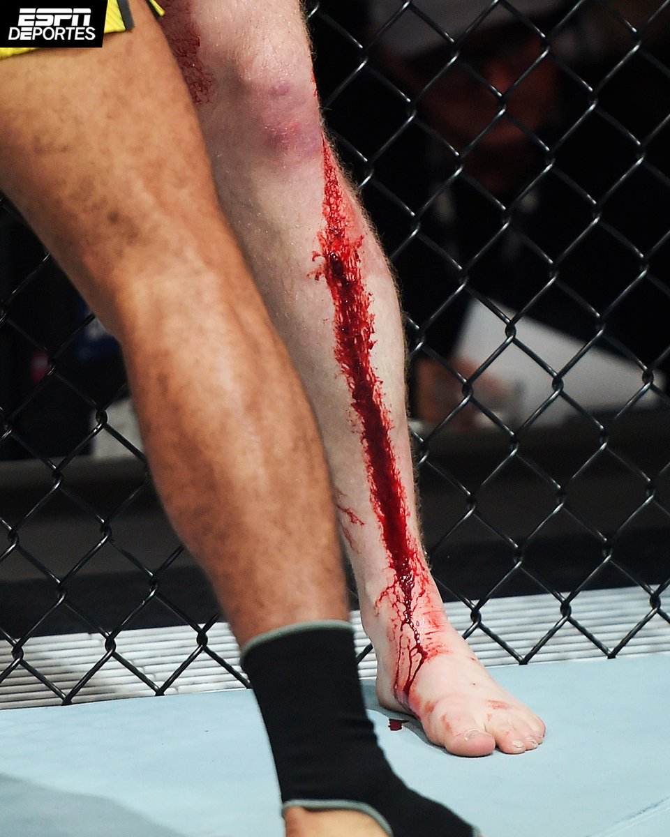 😨 El corte de Jack Shore. #UFC301