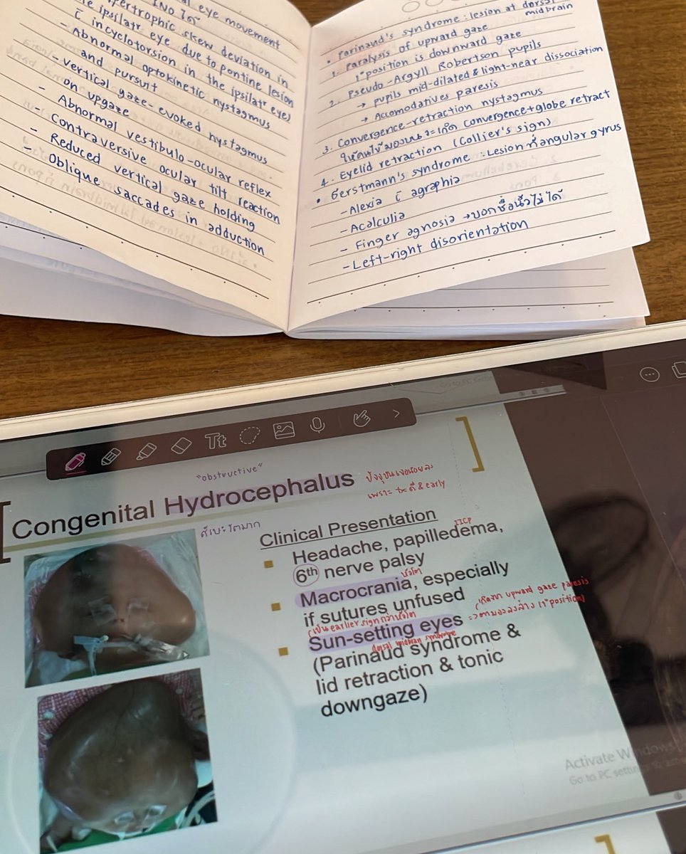 puddingrin2's tweet image. เขินมากไม่ได้เข้าแอคนี้นานเลย จนตอนนี้กำลังจะเปิดเทอมปี5 แร้ว🥺🥺 เราขึ้นศัลย์ก่อนมีคลิปให้เรียนล่วงหน้าเยอะมาก จาเปนลม🥲🥲