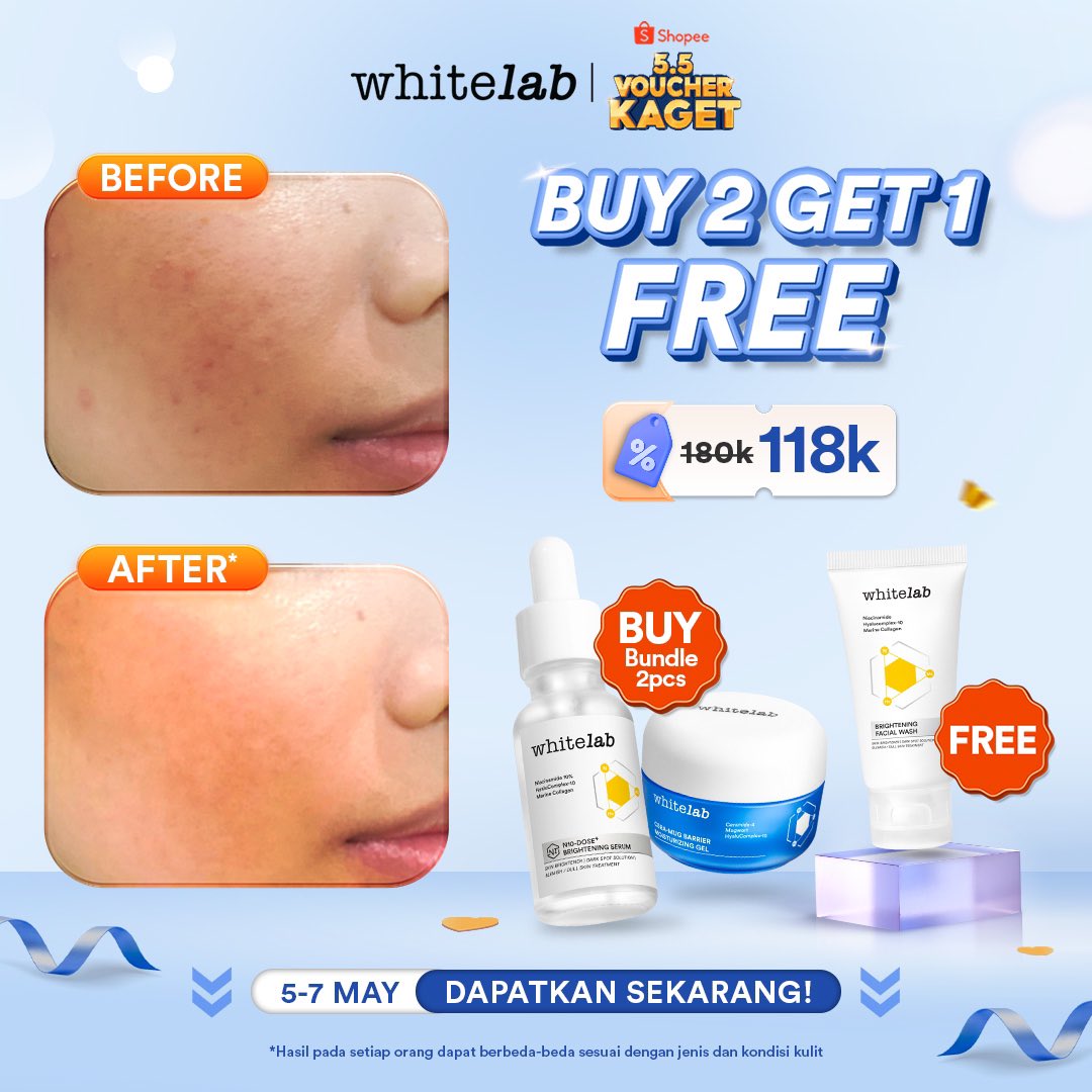 whitelab_id's tweet photo. 5.5 MEInuju Kulit Cerah📈✨
SALEEEEE‼️ ini kan yang kamu tunggu-tunggu? Diskonnya sampai 3 atau 4 hari tapi cuma hari ini FLASH SALE TERMURAH🥳
Coba cek aja sekarang!
Buy 2 Get 1 FREE
https://t.co/gWR3m6oUUz
#55SALE https://t.co/vJlhdOHgNu