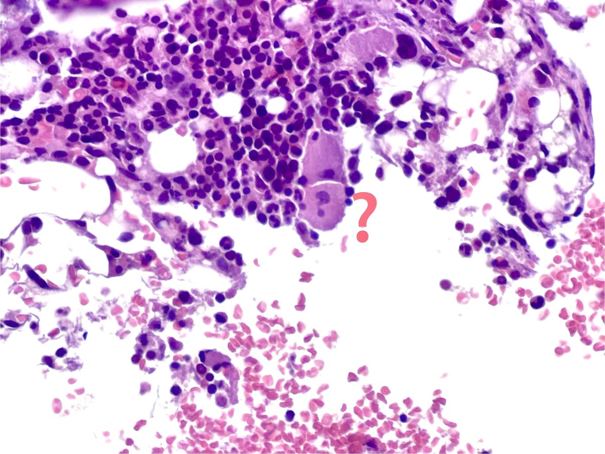 Question mark #PathArt #PediPath