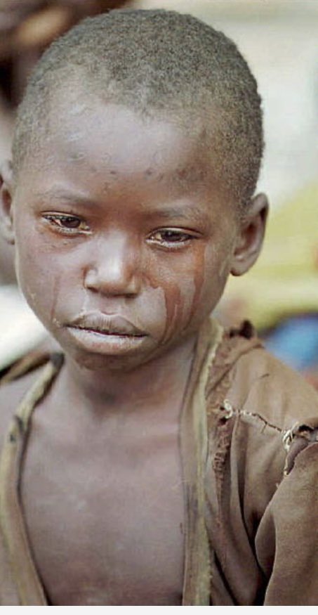 #Archive KIBEHO 1995 An orphan Hutu refugee sits crying in the Kibeho camp 29 April 1995 Reminder: INKOTANYI massacred over 8,000 refugees that night