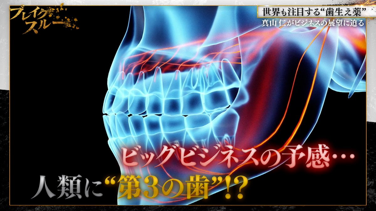 永久歯が抜けても…また歯が生える!?

今年の夏にも治験に入るという“歯を生やす薬”の開発。
永久歯が無くなれば歯は生えない。そんな常識を変えるため奮闘する、北野病院の歯科医師・高橋克氏に真山仁が迫る。

新たな選択肢として“歯を生やす薬”が実現するかもしれないー

#編集部ピックアップ📌