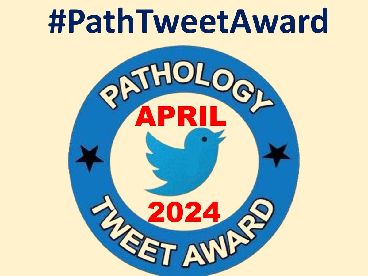 Over 90 Amazing,educational #pathtweet from APRIL 2024 are compiled for amazing #PathTweetAward @PathTweetAward platform Follow this thread to enjoy these #pathology tweets @cebulka26 @Path_Matt @Baskotacytopath @adi_agnihotri @ariella @archibhat3 @GIJamesMD @pembeoltulu…