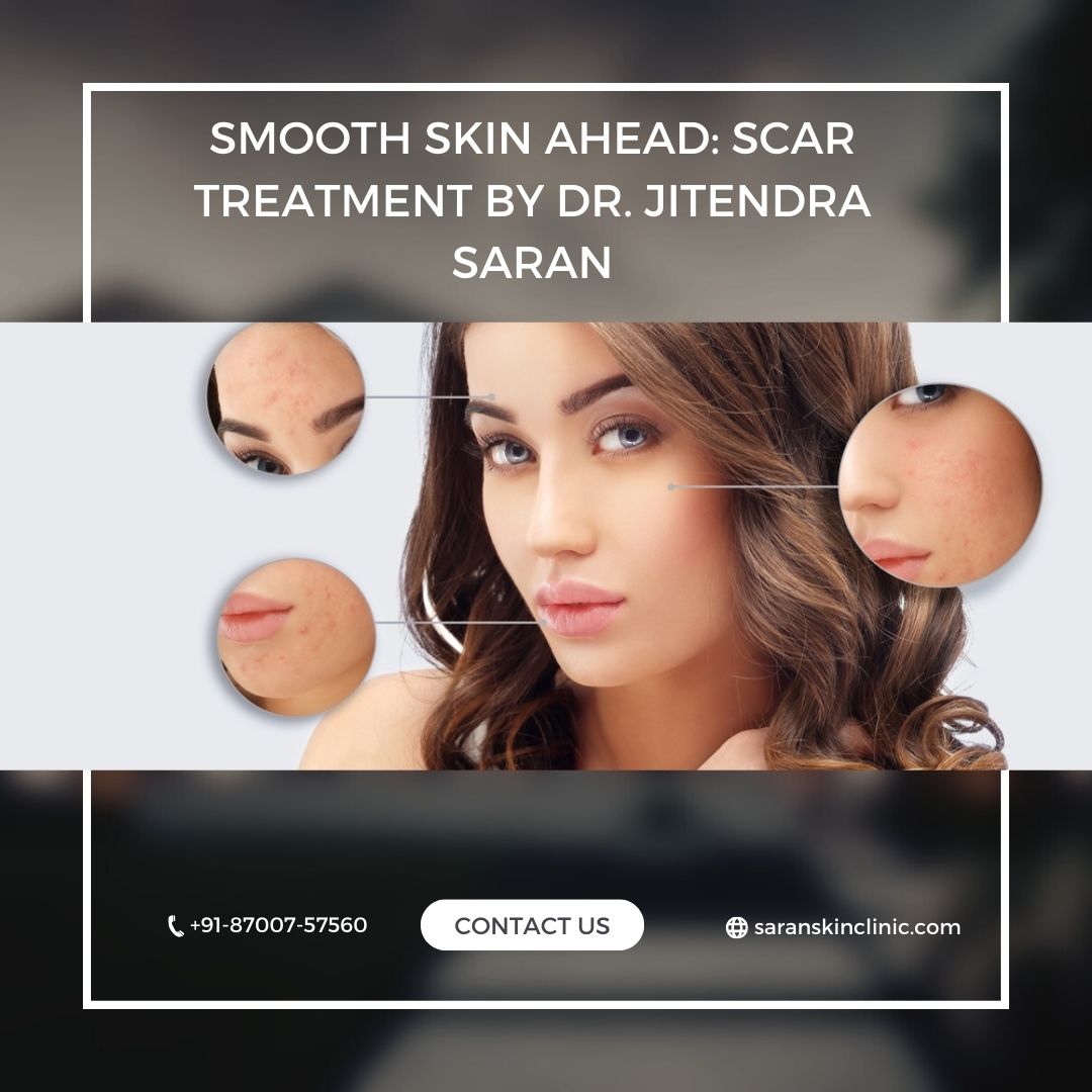 Scars don't have to be permanent with Dr. Jitendra Saran's specialized treatments. His advanced, personalized approach uses the latest laser technology, chemical peels, and microneedling to fade the appearance of acne scars, surgical scars, and other troubling marks.