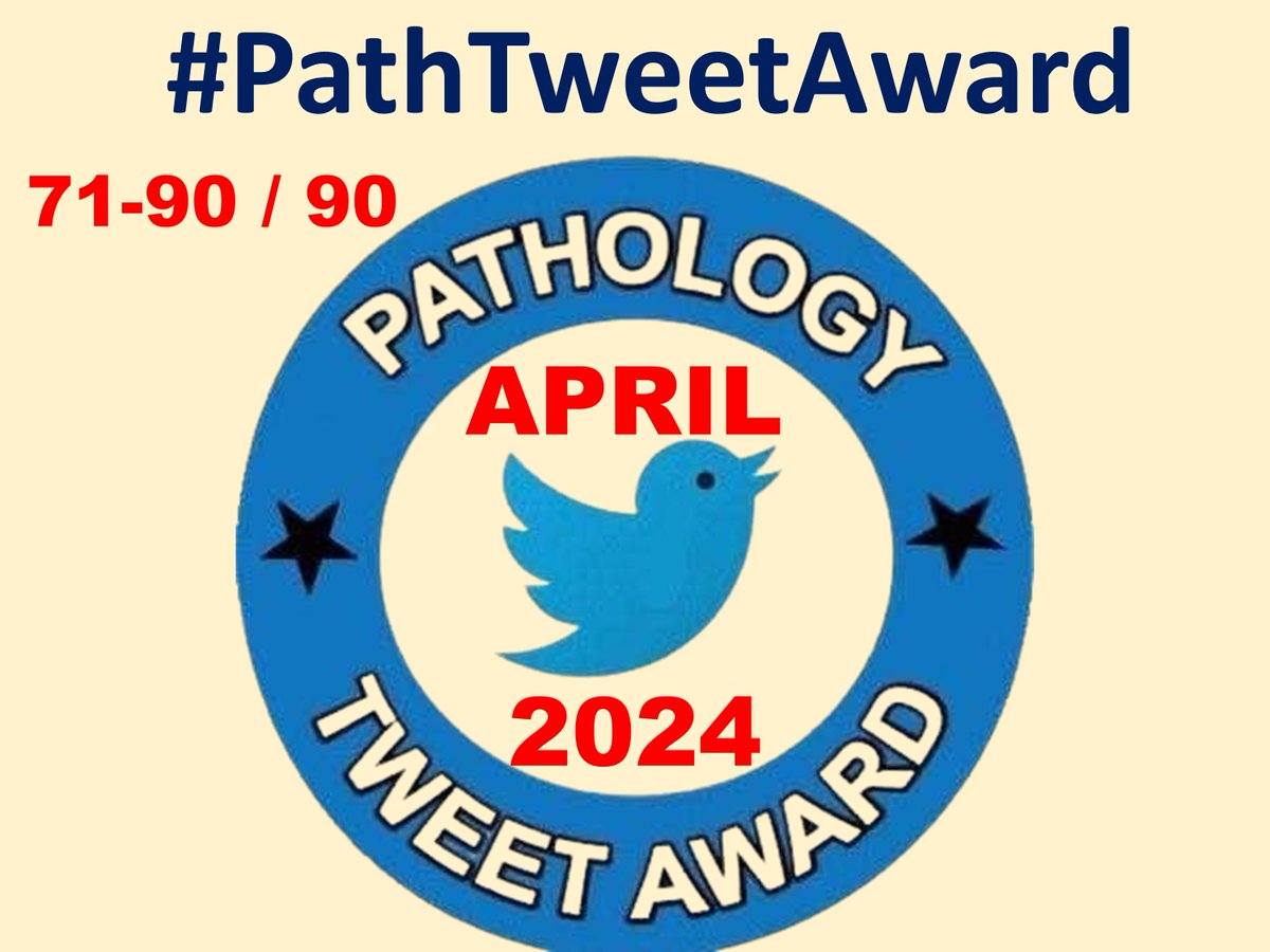 (71st to 90th tweet out of 90) Over 90 Amazing, educational #pathtweet from APRIL 2024 are compiled for amazing #PathTweetAward @PathTweetAward platform Follow this thread to enjoy these #pathology tweets @cebulka26 @Path_Matt @Baskotacytopath @adi_agnihotri @ariella…
