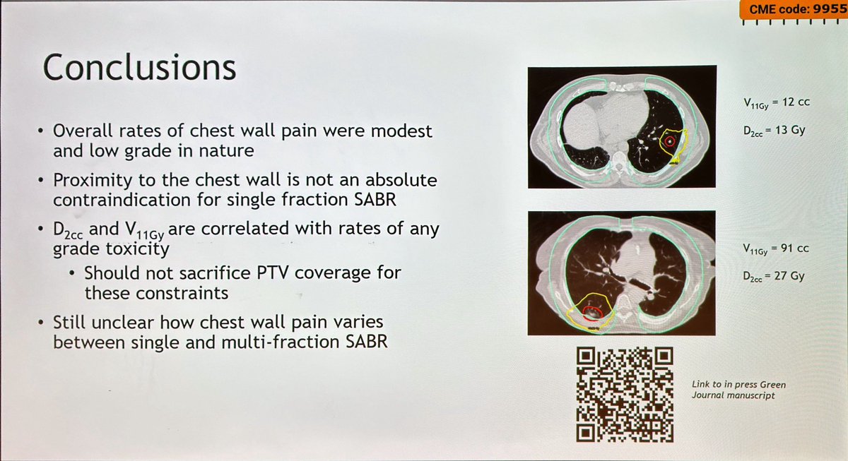 Continuing at #ESTRO24 lung mini oral @lukevitzthum presents analysis of @StanfordMed iSABR study chest wall toxicity ➡️ Overall rates of chest wall pain were modest and low grade in nature ➡️ D2cc and V11Gy are correlated with rates of any grade toxicity