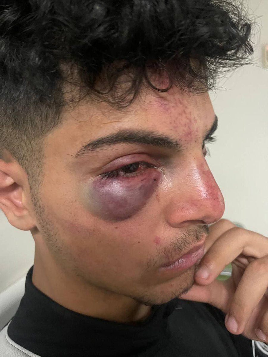 West Bank | IOF soldiers assaulted Adam Al-Rishq while he was jogging in the Old City of Jerusalem erusalem after settlers chased him while chanting the phrase “terrorist”