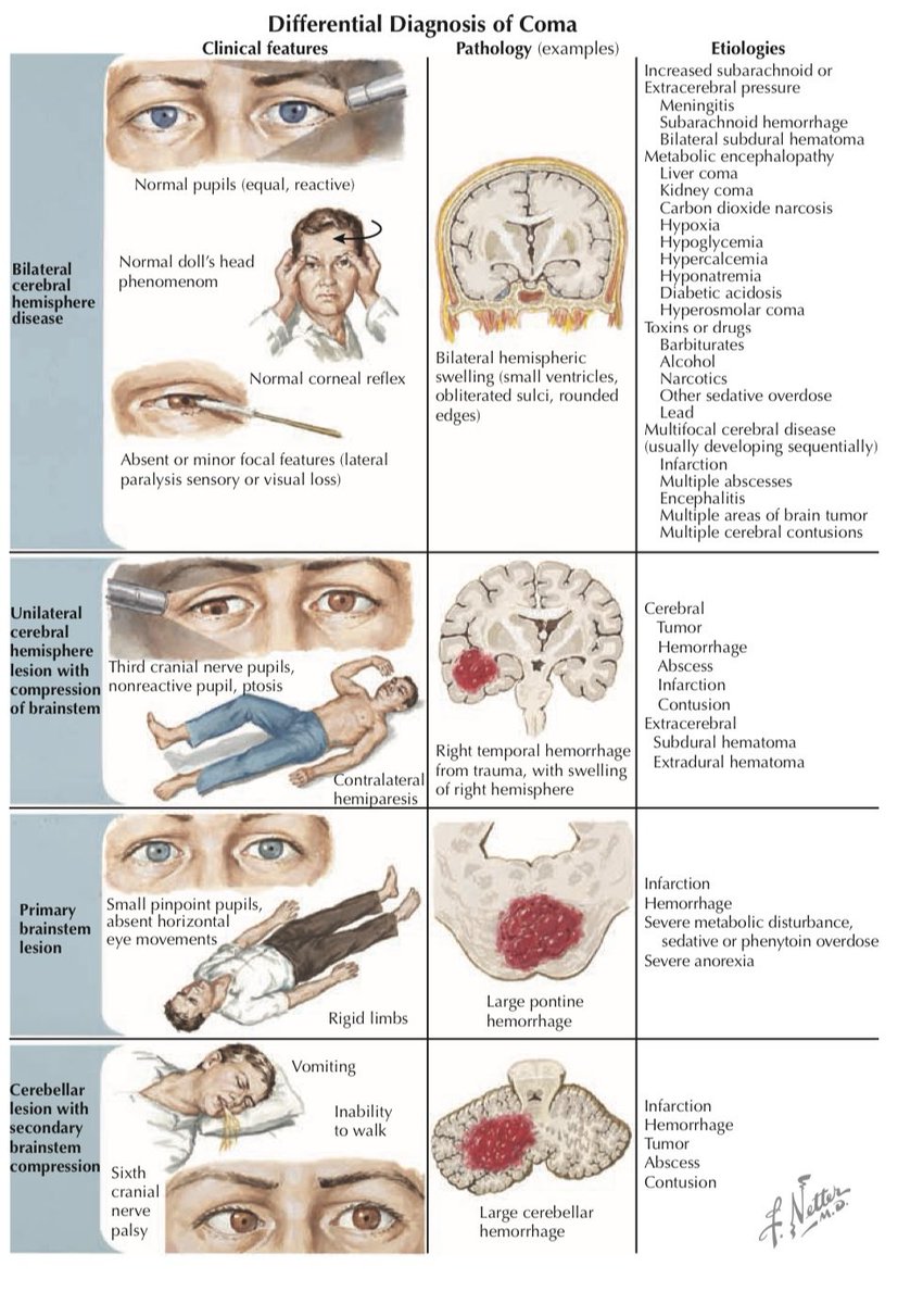 Coma primer