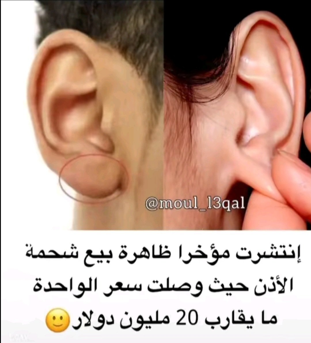 سعر بيع شحمة الاذن 20 مليون دولار ، وش يسون بها ؟ 😂