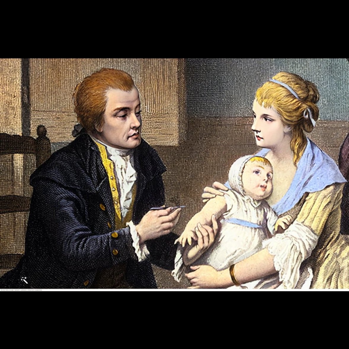 SMALLPOX VACCINE DISCOVERED ANNIVERSARY - 14 May 1796. Edward Jenner, a physician in rural England, developed a vaccination for smallpox, Within 18 months, 12,000 people in England had been vaccinated and the number of smallpox deaths dropped by two-thirds.
