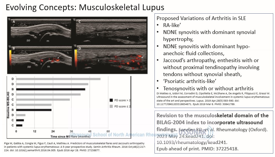 #KarinaTorralba discusses the complexity and heterogeneity of MSUS in #lupus -&gt; now 6 proposed subtypes of arthritis in #SLE

Incorporating MSUS in disease activity scores may allow for more accurate evaluation