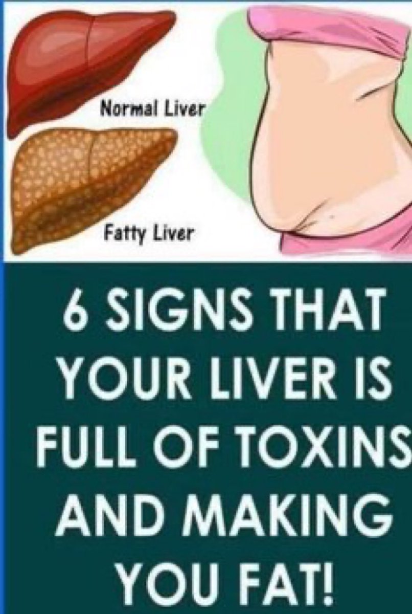 love4health_'s tweet image. Signs that your liver is full of Toxins,what a healthy liver looks like and Treatment 

A thread 🧵