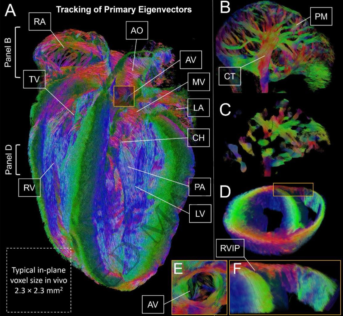 dmenefeepac's tweet photo. DT-CMR demonstrates the helical cardiomyocyte arrangement that drives rotation and torsion: septal-lateral, anterior-posterior and base-apex orientations in red, green and blue, respectively, extrapolating from ex vivo mouse heart https://t.co/D2DYyyUgHS https://t.co/bZnfLEuz2b