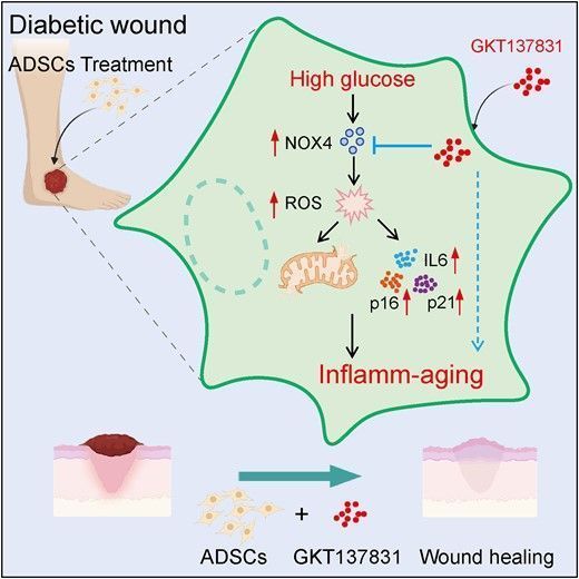 GKT137831, a NOX1/4 inhibitor, alleviates high glucose–induced inflammaging in adipose-derived stem cells through the NOX4/ROS/IL-6 pathway & enhances therapeutic effect of adipose-derived stem cells on healing. Read more in by Dong et al. #JLB buff.ly/4bsMTiS