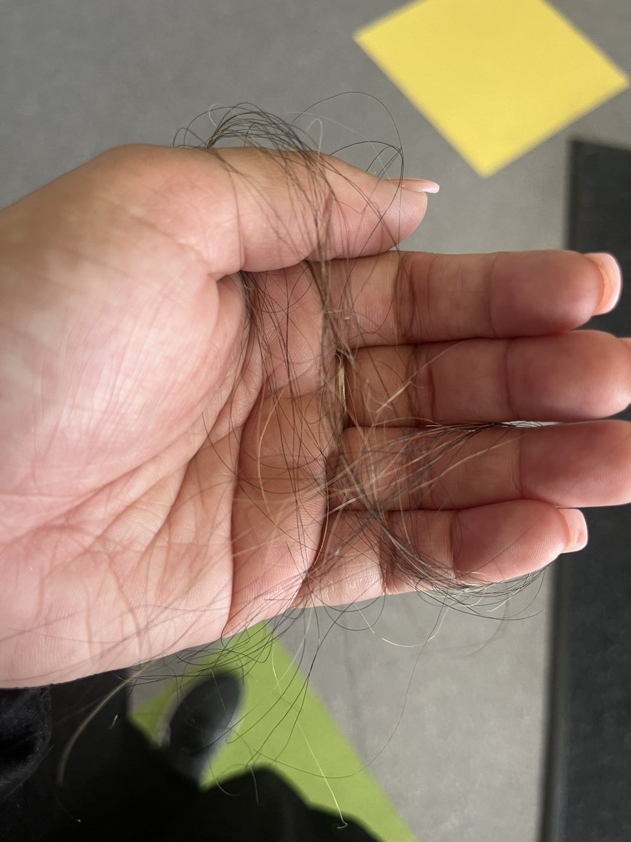 lexially's tweet image. This is what working in special education can look like. No that’s not from stress, a child pulled a chunk out of my hair. Yes on purpose. #specialeducation#teachers