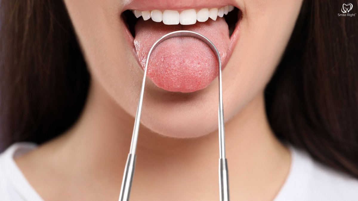 Did you know that your tongue is as unique as your fingerprints? 😋 It's true! Your tongue has its own distinct pattern of ridges and bumps that make it one of a kind. Next time you look in the mirror, take a close look at your tongue and marvel at its uniqueness.
