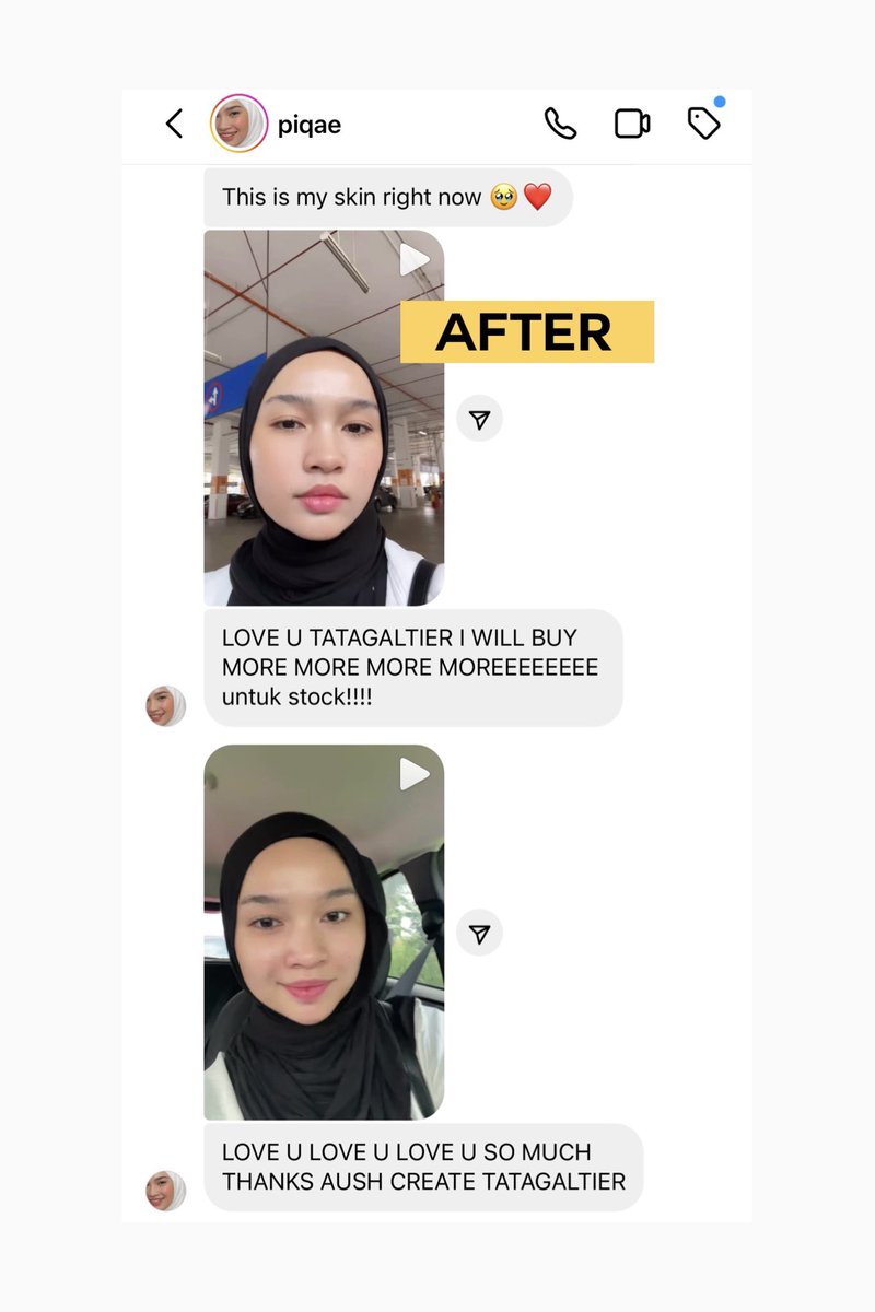 tatagaltier's tweet photo. Say goodbye to harsh stripping and hello to fresh, calm skin post-cleansing. It's time to treat yourself to the gentle care your skin has been craving 🧤!
We're curious to know—when do you use our Cella Grail Cleansing Gel, and how many times a day?
#Tatagaltier #TehBunga🌼 https://t.co/QthnHKppm3