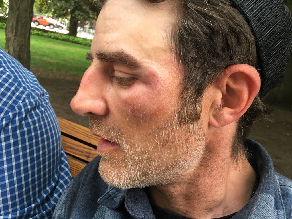 🚨🚨🚨 My client Christopher Dacey was violently assaulted and robbed by masked assailants in Ottawa’s Confederation Park on May 17, 2024 at approximately 6 pm. The attack appears premeditated and may constitute intimidation of a justice system participant. Joe Morin (from