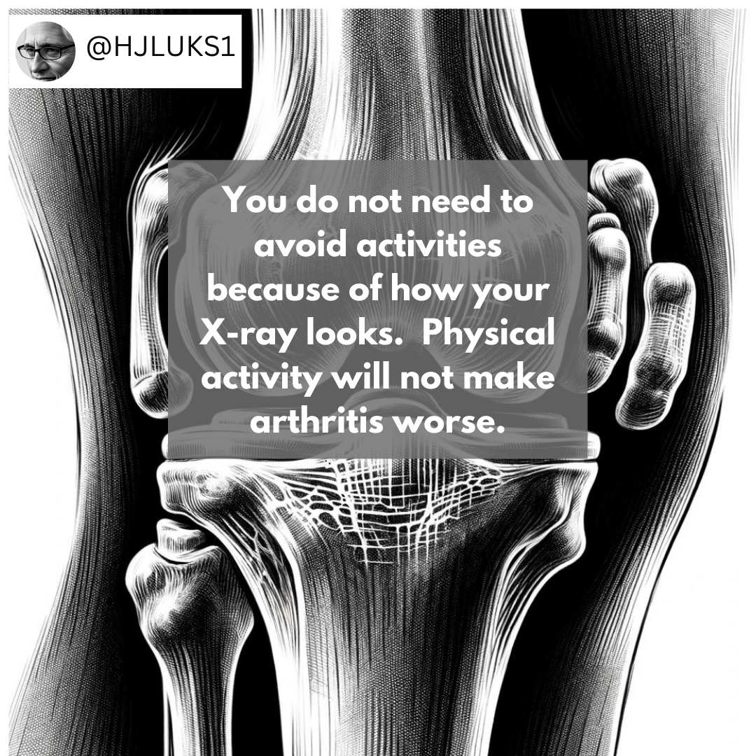 hjluks's tweet photo. Bone on bone and other similar phrases aren't very helpful... and often, they alarm patients.  You may not know it, but those few words can stop someone from exercising because they're scared.  I've seen this too often to count. https://t.co/ampGU0JHYL