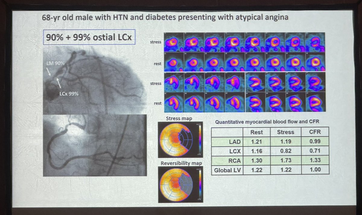 Why PET? 1. Epidemiology of ischemic diseases has changed 2.Flow quantification is no longer an option 3. Example of px with 1 vessel obstructed but with low overall flows #ICNCCT2024 #CvNuc