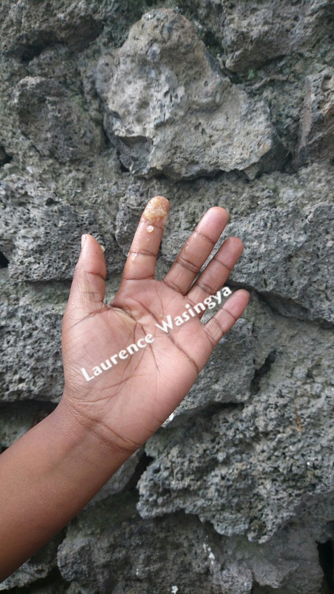MuhiraLaurence's tweet photo. **#MaladiesSexuellementTransmissibles  Adolescents**:Le manque d'information est l'ennemi  n°1 !Brisons le silence et protégeons nos jeunes.Suivez l'émission #WatotoRadio sur BoraFM 103.5 MHz ou sur https://t.co/H3UOsohIOH à partir d 14h00 pour en savoir plus. #Goma #RDC #MST https://t.co/OUFQAMUgj3