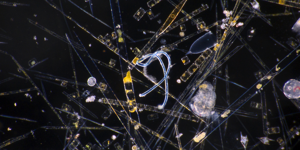 We've made our mark but, who cares? (Rt if you care). Plastic pollution at the scale of the phytoplankton. Every inshore plankton sample I collect contains microplastics. (This was sampled yesterday) @zeiss_micro