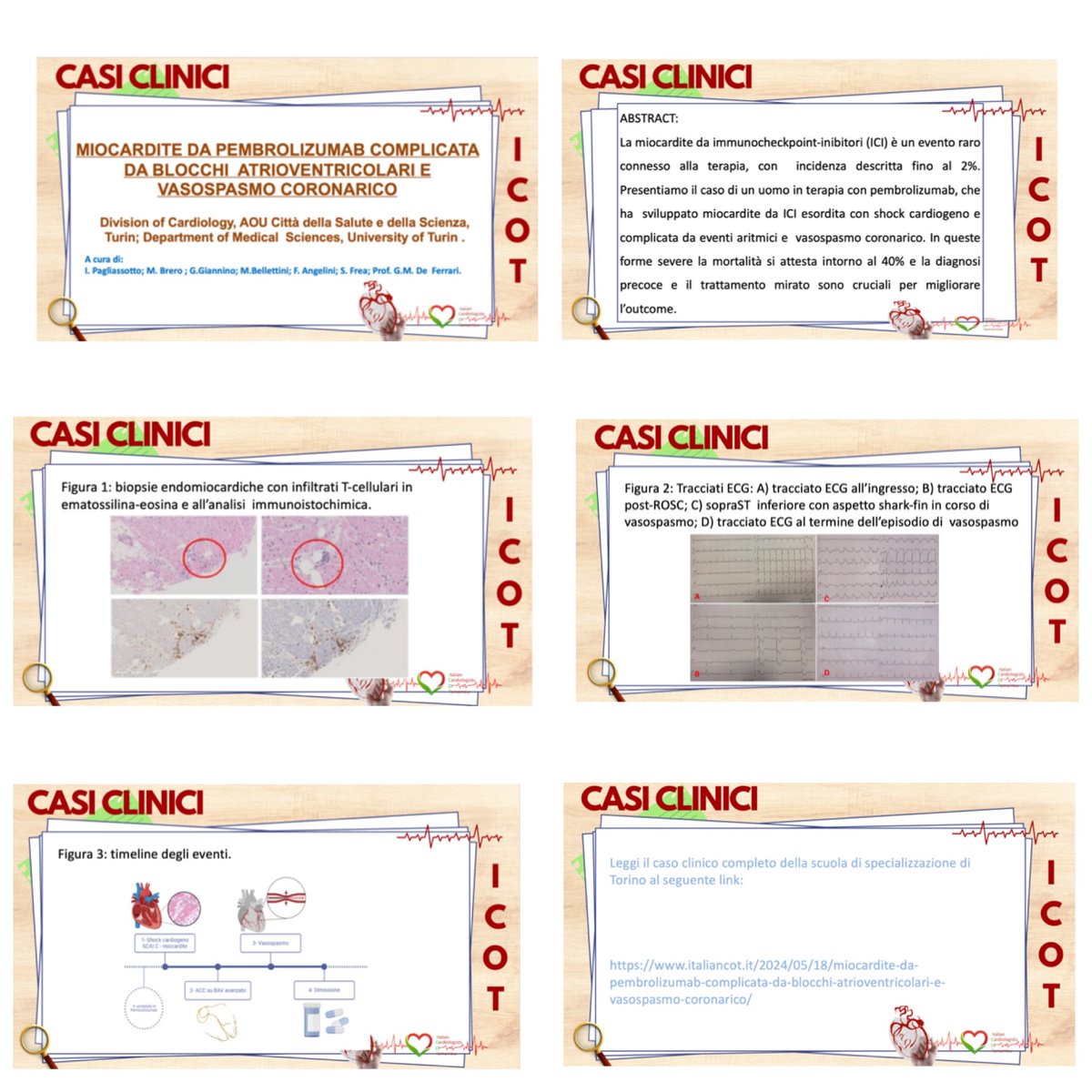 -ICOT Clinical case of the week 
🫀Miocardite da pembrolizumab complicata da blocchi atrioventricolari e vasospasmo coronarico🫀

❗️Leggi il caso clinico urly.it/3_a1g
#cardiology #cardiologyfellow #cardiologia #cardiovascular #myocarditis #cardiac #ITcardiology
