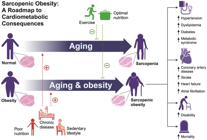 🔴Sarcopenic Obesity and Cardiovascular Disease: An Overlooked but High-Risk Syndrome #2024Review #openaccess 

✅link.springer.com/article/10.100… 
 #medtwitter #meded #cardiovascular #MedEd #MedX #Cardiology #Cardiology #CardioTwitter #CardioEd #MedTwitter #paramedic #FOAMed