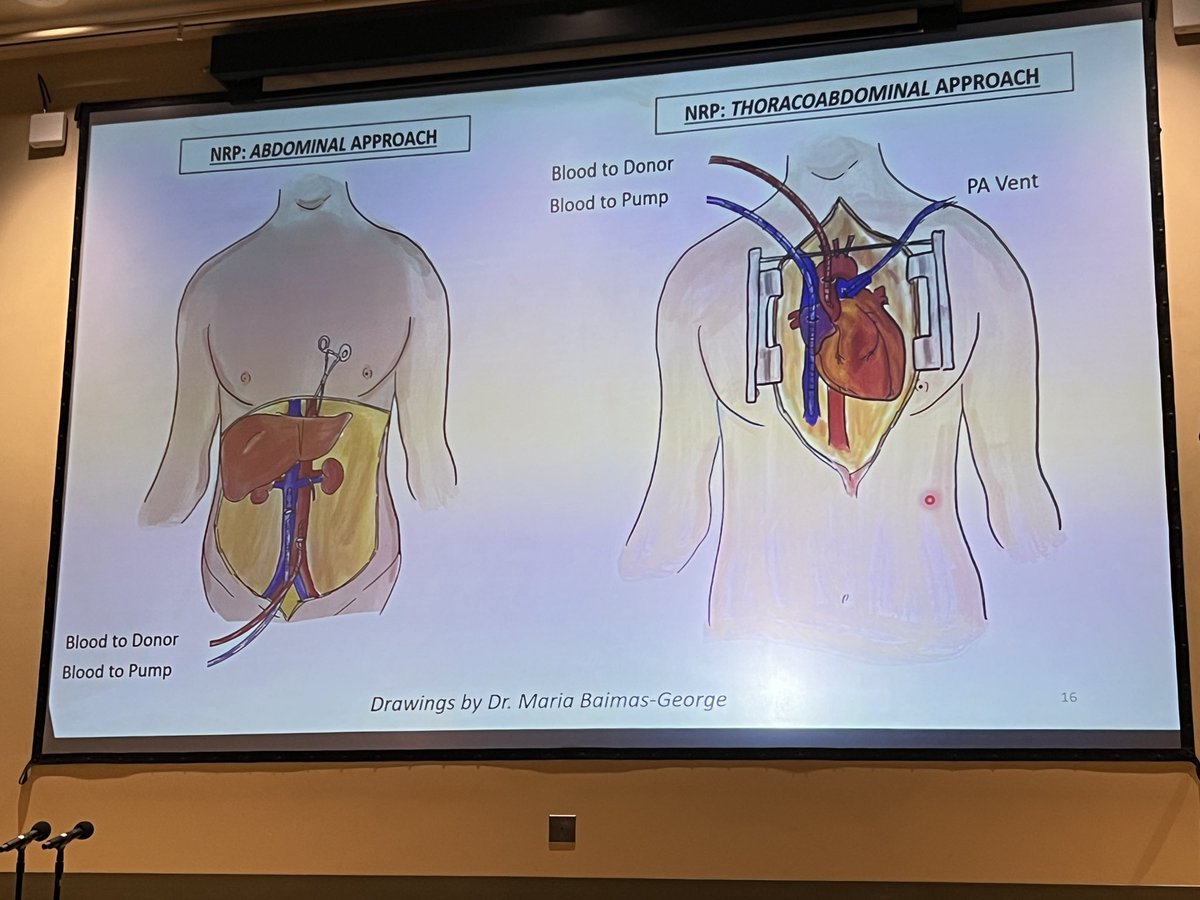 Dr Pomfret @drlizpomfret from @CU_Transplant  enlightened us with the many advantages of normothermic regional perfusion in abdominal transplantation on the Wednesday @InstituteStarzl grand rounds! It’s so nice to have her visit us!