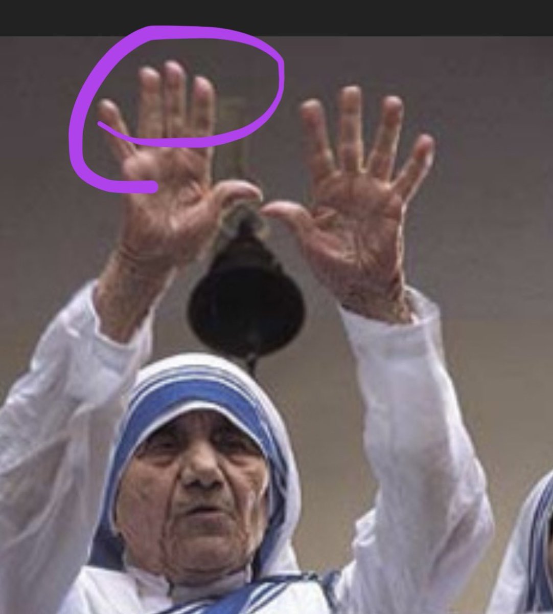 @QPATRIOTMLO1 Yes, GONE 
Same with his Father #MotherTeresa IS A MAN
If the ring ginger is longer than the index finger = MAN 
Both WERE #pedos #satanicworship #HumanTrafficking #sodomy #PureEvil