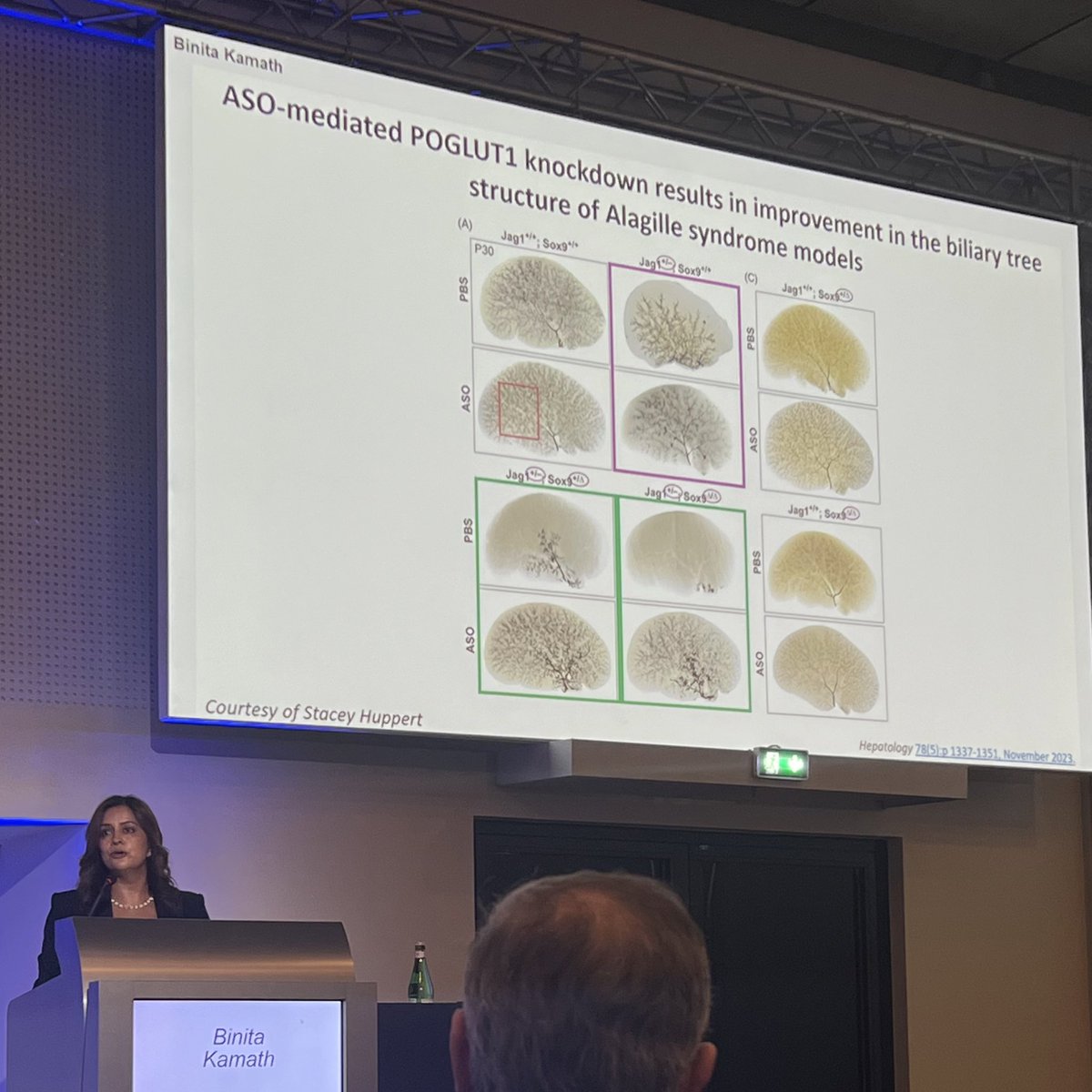 odsuoglu's tweet image. New horizons:: "Bile duct augmentation can be the future rational treatment for Allagile syndrome associated liver disease" stated Binita Kamath during her amazing Key Note Lecture on the final day. @ESPGHANSociety #ESPGHAN2024 #ESPGHANambassador