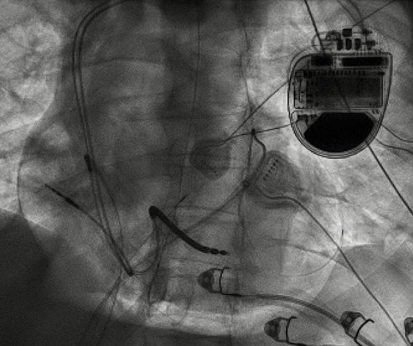 Virtua Heart Rhythm Specialists tweet media